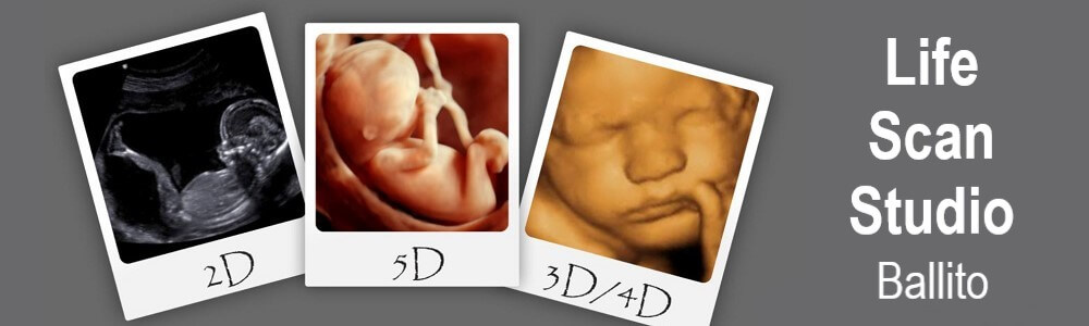 Life Scan Studio Ballito banner